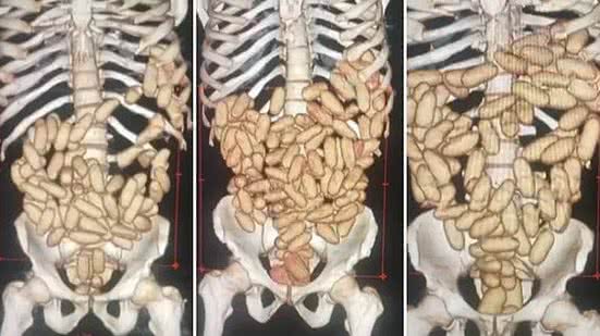 Reprodução / Globonews