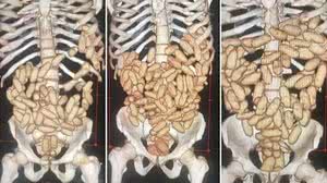 Reprodução / Globonews