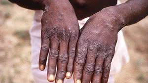 Comitê consultivo vai acompanhar desdobramentos científicos do vírus | Foto: CDC/BRIAN W.J. MAHY