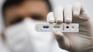 Imagem Cidade de Flexeiras, na Zona da Mata, inicia testes em massa para covid-19