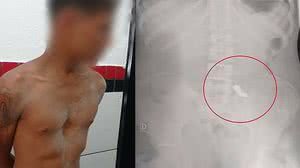 Reprodução/Facebook/Guaru.tv