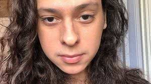 Victor Meyniel foi espancado na portaria de um prédio do Rio de Janeiro no último sábado | Reprodução / Instagram