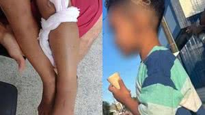 Imagem Criança vai para a UTI após confundir cobra com galho durante brincadeira no litoral de SP