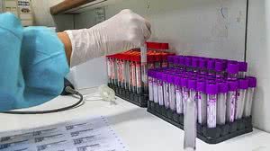 Foto: Agência Brasília