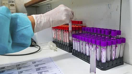 Foto: Agência Brasília