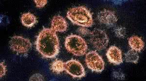 NIAID-RML via AP/Arquivo