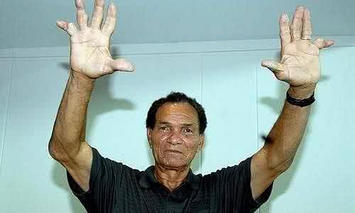 Sem dinheiro e doente, ex-goleiro Manga &eacute; abra&ccedil;ado por uruguaios