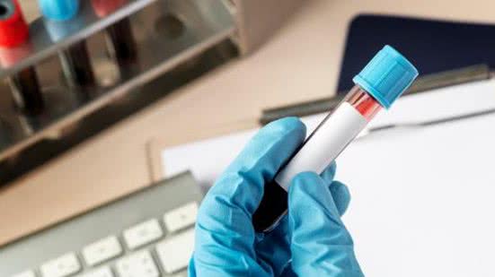 Foto: Reprodução/Freepik