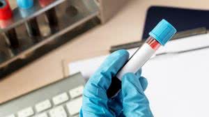 Foto: Reprodução/Freepik