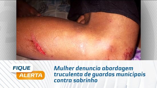 Mulher denuncia abordagem truculenta de guardas municipais contra sobrinho