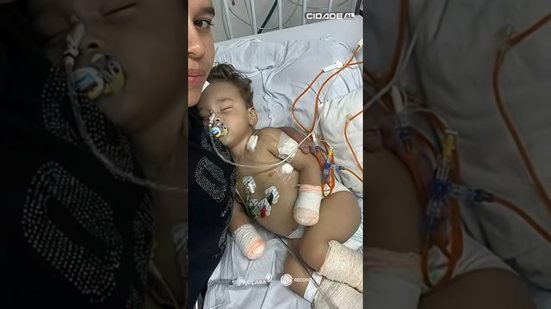 DESTAQUES: Cidade AL traz o caso da criança que teve membros amputados e outras notícias #CidadeAL