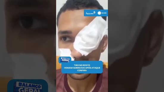 🚨Homem é baleado no rosto durante tentativa de homicídio a caminho de Arapiraca #BalançoGeralAL