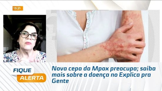 Nova cepa da Mpox preocupa; saiba mais sobre a doença no Explica pra Gente