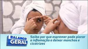 Saiba por que espremer pode piorar a inflamação e deixar manchas e cicatrizes