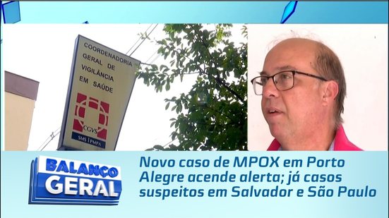 Novo caso de MPOX em Porto Alegre acende alerta; já casos suspeitos em Salvador e São Paulo