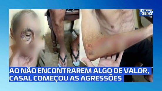 Idoso de 80 anos é espancado por casal de criminosos em Arapiraca