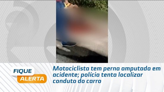 Motociclista tem perna amputada em acidente; polícia tenta localizar conduto do carro