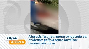 Motociclista tem perna amputada em acidente; polícia tenta localizar conduto do carro
