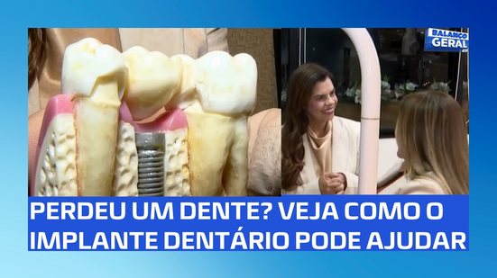 🦷 Implante dentário: saiba como funciona e quando pode ser indicado