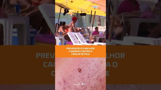 Proteção solar e atenção aos sinais podem evitar complicações #FiqueAlerta