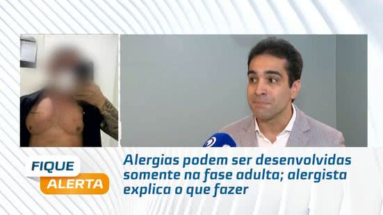 Alergias podem ser desenvolvidas somente na fase adulta; alergista explica o que fazer