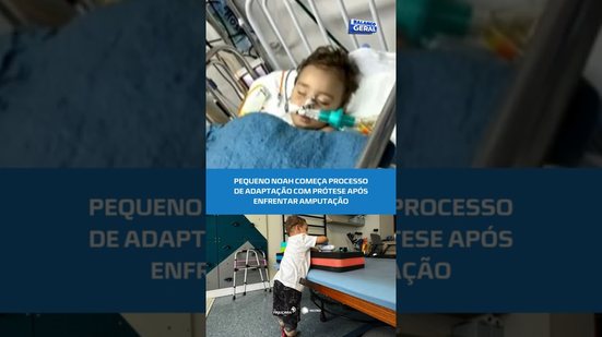 Pequeno Noah inicia nova fase com uso de próteses #BalançoGeralAL