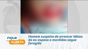 Homem suspeito de arrancar lábios da ex-esposa a mordidas segue foragido
