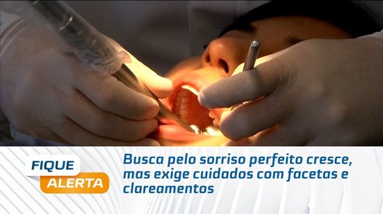 Busca pelo sorriso perfeito cresce, mas exige cuidados com facetas e clareamentos