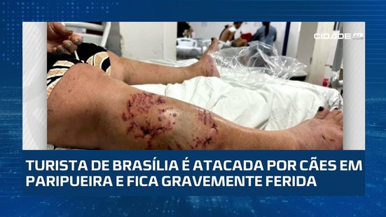 Turista de Brasília é atacada por cães em Paripueira e fica gravemente ferida