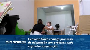 Pequeno Noah começa processo de adaptação com próteses após enfrentar amputação