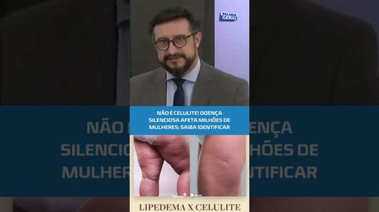 🩺Lipedema pode causar dor e limitar a qualidade de vida; entenda #BalançoGeralAL