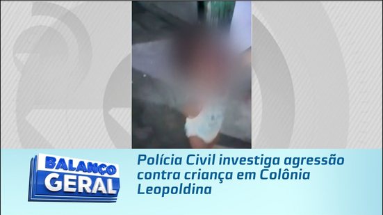 Polícia Civil investiga agressão contra criança em Colônia Leopoldina
