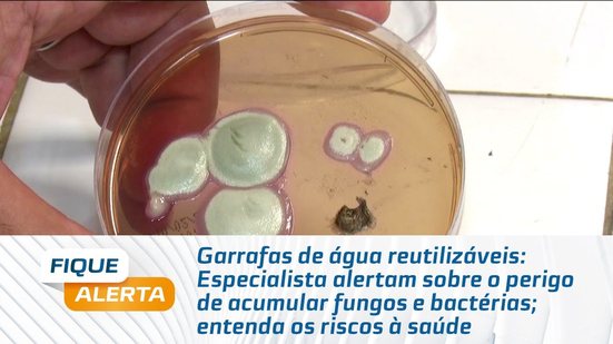 Especialista alertam sobre o perigo de acumular fungos e bactérias; entenda os riscos à saúde