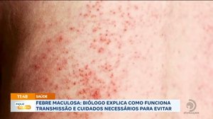Febre maculosa: Biólogo explica como funciona transmissão e cuidados necessários para evitar
