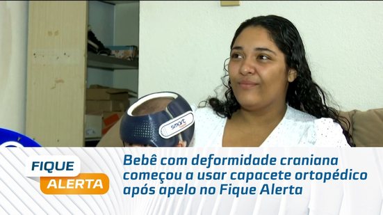 Bebê com deformidade craniana começou a usar capacete ortopédico após apelo no Fique Alerta
