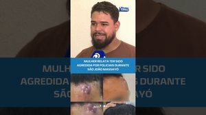 🚨Mulher denuncia agressão de policiais do BOPE durante show do São João Massayó #BalançoGeralAL