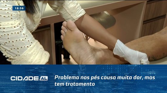 Fascite Plantar: Problema nos pés causa muita dor, mas tem tratamento