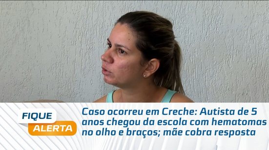 Autista de 5 anos chegou da escola com hematomas no olho e braços; mãe cobra resposta