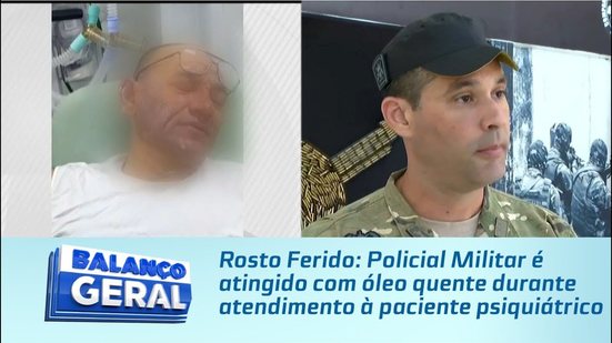 Policial Militar é atingido com óleo quente durante atendimento à paciente psiquiátrico