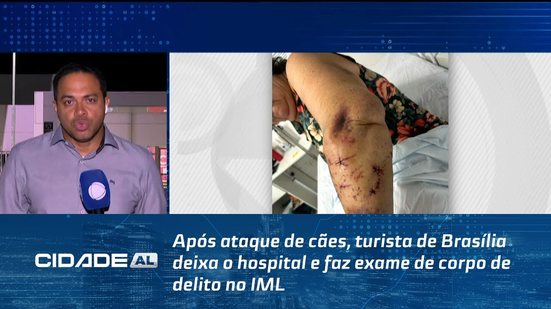 Após ataque de cães, turista de Brasília deixa o hospital e faz exame de corpo de delito no IML