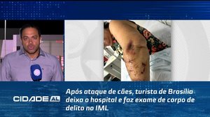 Após ataque de cães, turista de Brasília deixa o hospital e faz exame de corpo de delito no IML