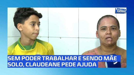 Após queimaduras graves, tosadora pede ajuda para comprar remédios e pagar despesas