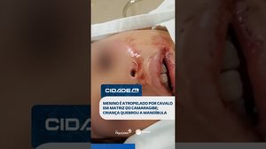 DESTAQUES: Menino é atropelado por cavalo em Matriz do Camaragibe #CidadeAL