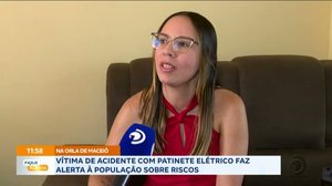 Vítima de acidente com patinete elétrico faz alerta à população sobre riscos