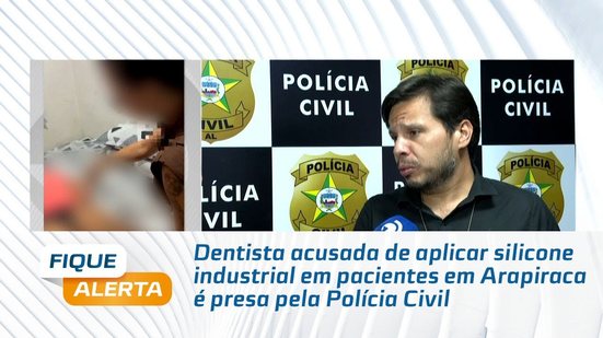 Dentista acusada de aplicar silicone industrial em pacientes em Arapiraca é presa pela Polícia Civil