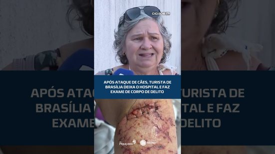 Após ataque de cães, turista de brasília deixa o hospital e faz exame de corpo de delito #CidadeAL