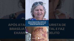 Após ataque de cães, turista de brasília deixa o hospital e faz exame de corpo de delito #CidadeAL