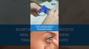 PARTE 1: Cuidado, uso errado de lentes pode prejudicar seriamente a visão #BalançoGeralAL