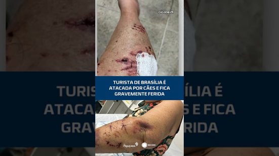 Turista de Brasília é atacada por cães e fica gravemente ferida #CidadeAL