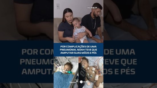 Por complicações de uma pneumonia, noah teve que amputar suas mãos e pés #CidadeAL